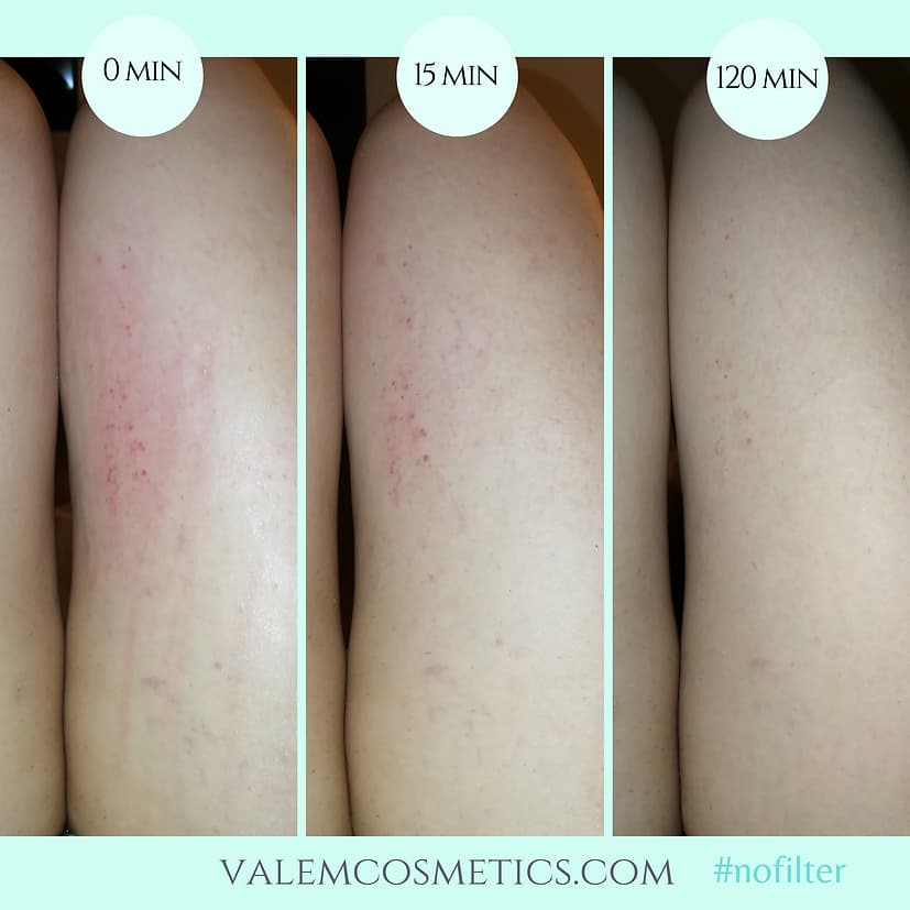 ALL DAY & POST-PROCEDURE BODY CREAM