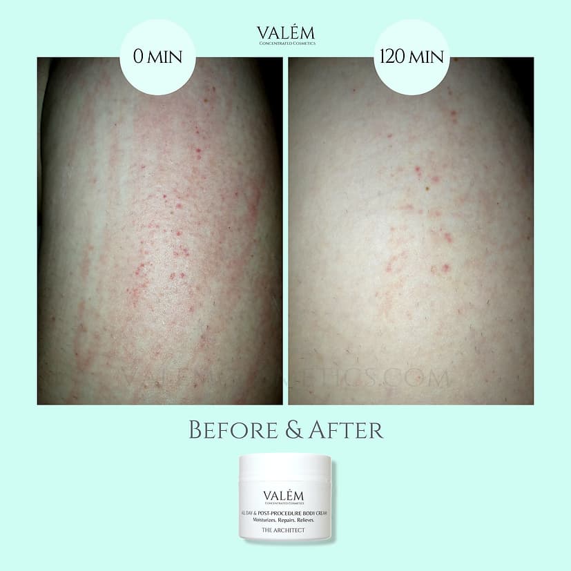 ALL DAY & POST-PROCEDURE BODY CREAM